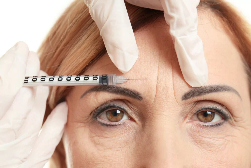 Aplicação de Harmonização Facial para tratamento de rugas