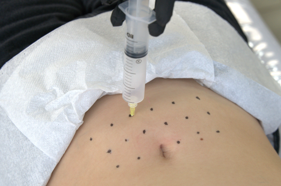 Ozonioterapia - Tratamento integrativo